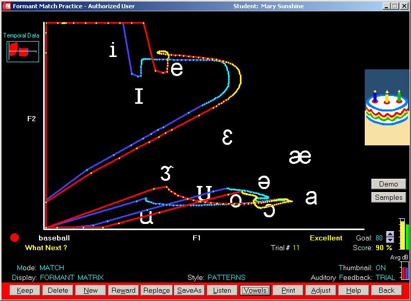 Sample Formant Matrix Display Screen