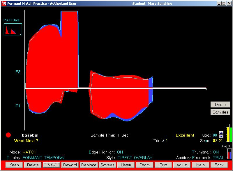 Sample Formant Temporal Display Screen