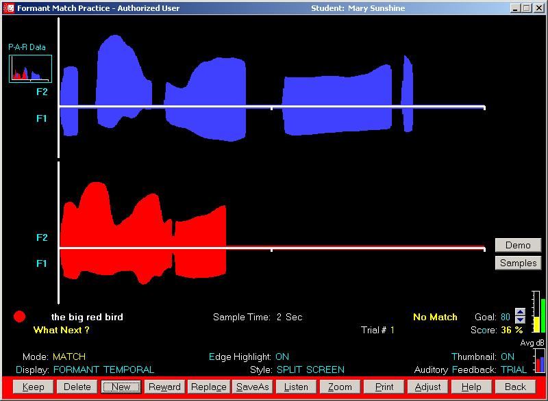 Sample Formant Temporal Display Screen