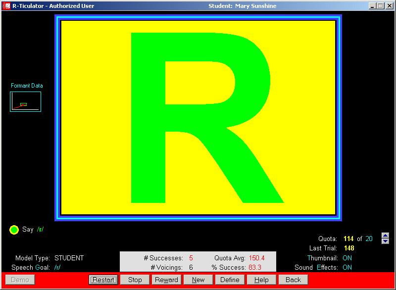 Learn more about the R-Ticulator