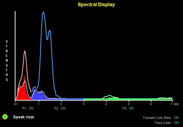 Sample Formant Multi-Frequency Spectral Display Screen